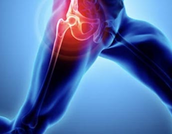 Exactech Knee, Hip, Ankle Recalls